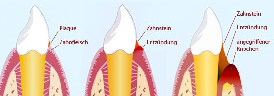 Dr.-Ernst-Kolb-Leistungen-Parodontologie-1-Zahnarztpraxis-Privatpraxis-Eggelsberg-Braunau-Salzburg-Implantologie-zahnimplantologe.at