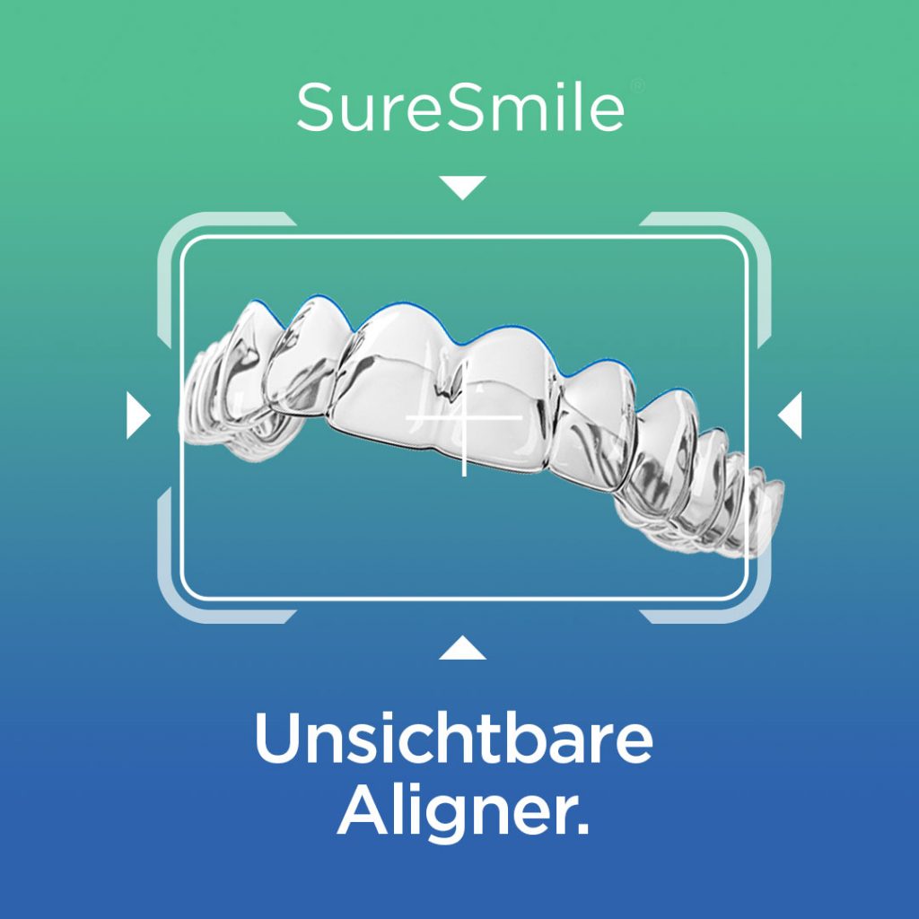 SureSmile-Aligner-Schienentherapie-Zahnarztpraxis-Privatpraxis-Eggelsberg-Braunau-Salzburg-Implantologie-zahnimplantologe.at